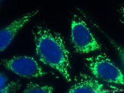 GSK3A Rabbit anti-Human, Mouse, Rat, Zebrafish, Polyclonal, Proteintech