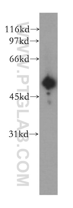 GSK3A Rabbit anti-Human, Mouse, Rat, Zebrafish, Polyclonal, Proteintech
