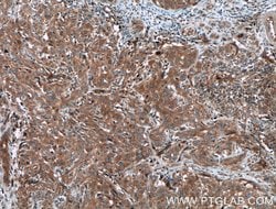 PPP3CA Rabbit anti-Human, Mouse, Polyclonal, Proteintech 150 &mu;L; Unconjugated:Antibodies,