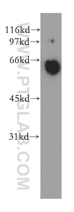 PPP3CA Rabbit anti-Human, Mouse, Polyclonal, Proteintech 150 &mu;L; Unconjugated:Antibodies,