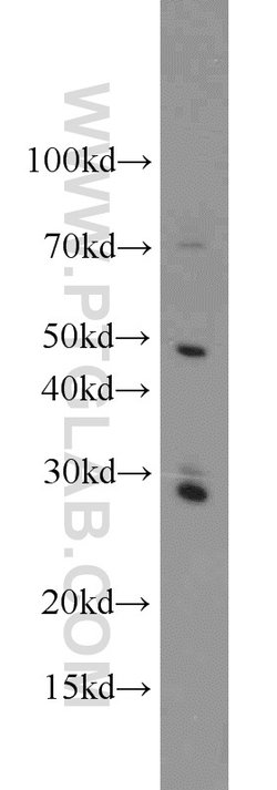 Caspase 8 Rabbit anti-Human, Mouse, Polyclonal, Proteintech 150 &mu;L;