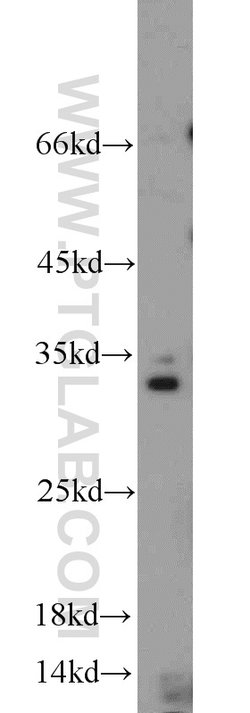 Caspase 8 Rabbit anti-Human, Mouse, Polyclonal, Proteintech 150 &mu;L;