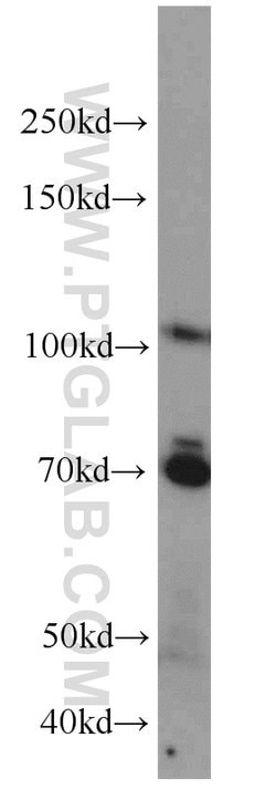 Proteintech E2F8 Rabbit anti-Human, Mouse, Rat, Polyclonal, Proteintech