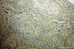 POLR2C Rabbit anti-Human, Mouse, Rat, Polyclonal, Proteintech:Antibodies:Primary