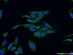 NDUFV3 Rabbit anti-Human, Polyclonal, Proteintech:Antibodies:Primary Antibodies