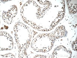ALS2CR8 Rabbit anti-Human, Polyclonal, Proteintech 150 &mu;L; Unconjugated:Antibodies,