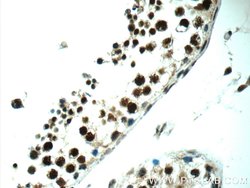 ALS2CR8 Rabbit anti-Human, Polyclonal, Proteintech 150 &mu;L; Unconjugated:Antibodies,