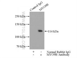 NNT Rabbit anti-Human, Mouse, Rat, Polyclonal, Proteintech 150 &mu;L; Unconjugated:Antibodies,