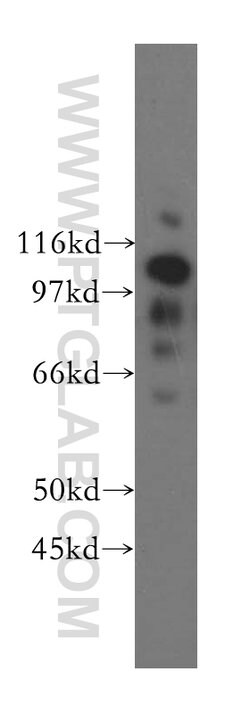 NNT Rabbit anti-Human, Mouse, Rat, Polyclonal, Proteintech 150 &mu;L; Unconjugated:Antibodies,
