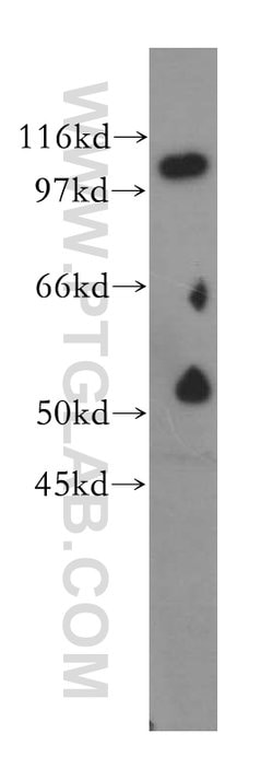 NNT Rabbit anti-Human, Mouse, Rat, Polyclonal, Proteintech 150 &mu;L; Unconjugated:Antibodies,