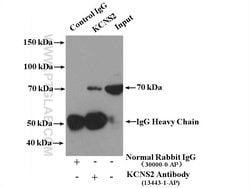 KCNS2 Rabbit anti-Human, Mouse, Rat, Polyclonal, Proteintech 150 &mu;L;