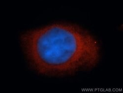 DVL3 Rabbit anti-Human, Polyclonal, Proteintech 150 μL; Unconjugated:Antibodies,