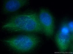 DVL3 Rabbit anti-Human, Polyclonal, Proteintech 150 μL; Unconjugated:Antibodies,