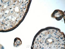 SIGLEC6 Rabbit anti-Human, Polyclonal, Proteintech 150 &mu;L; Unconjugated:Antibodies,