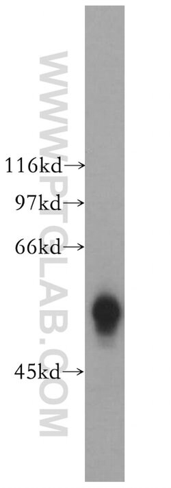 GK5 Rabbit anti-Human, Mouse, Rat, Polyclonal, Proteintech 150 &mu;L; Unconjugated:Antibodies,