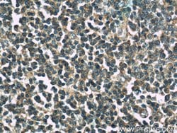 BPIL1 Rabbit anti-Human, Polyclonal, Proteintech:Antibodies:Primary Antibodies