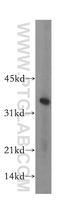 HIBADH Rabbit anti-Human, Mouse, Rat, Polyclonal, Proteintech 150 &mu;L;