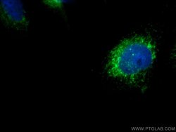 SDCCAG8 Rabbit anti-Canine, Human, Mouse, Rat, Zebrafish, Polyclonal, Proteintech:Antibodies:Primary