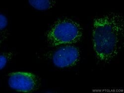 SDCCAG8 Rabbit anti-Canine, Human, Mouse, Rat, Zebrafish, Polyclonal, Proteintech:Antibodies:Primary