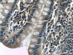 SDCCAG8 Rabbit anti-Canine, Human, Mouse, Rat, Zebrafish, Polyclonal, Proteintech:Antibodies:Primary