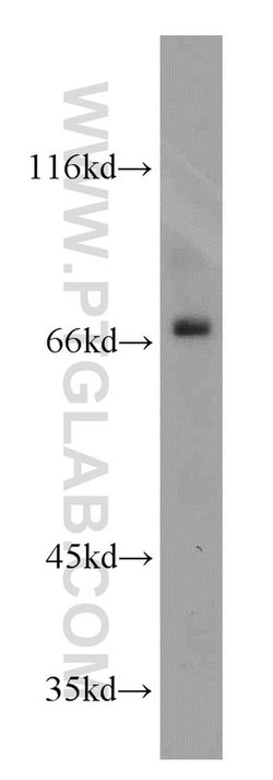SDCCAG8 Rabbit anti-Canine, Human, Mouse, Rat, Zebrafish, Polyclonal, Proteintech:Antibodies:Primary