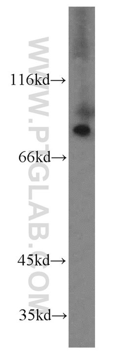 SDCCAG8 Rabbit anti-Canine, Human, Mouse, Rat, Zebrafish, Polyclonal, Proteintech:Antibodies:Primary