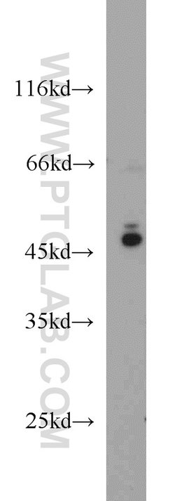 VASP Rabbit anti-Human, Mouse, Rat, Polyclonal, Proteintech 150 &mu;L;