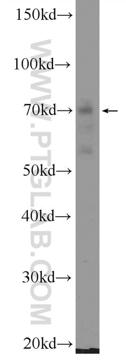 Cryptochrome 1 Rabbit anti-Human, Mouse, Rat, Polyclonal, Proteintech 150