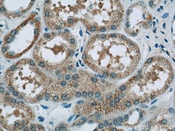 ALLC Rabbit anti-Human, Mouse, Rat, Polyclonal, Proteintech:Antibodies:Primary
