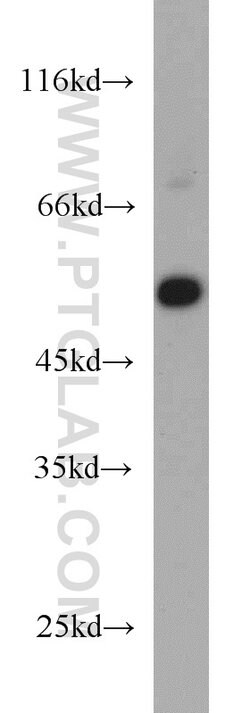 EVL Rabbit anti-Human, Mouse, Rat, Polyclonal, Proteintech 150 &mu;L; Unconjugated:Antibodies,