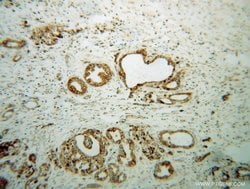 B3GALT4 Rabbit anti-Human, Mouse, Rat, Polyclonal, Proteintech 150 &mu;L;