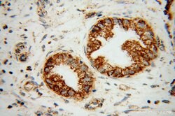 B3GALT4 Rabbit anti-Human, Mouse, Rat, Polyclonal, Proteintech 150 &mu;L;