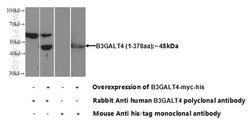 B3GALT4 Rabbit anti-Human, Mouse, Rat, Polyclonal, Proteintech 150 &mu;L;