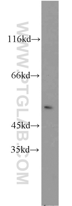 EGR2 Rabbit anti-Human, Mouse, Rat, Polyclonal, Proteintech 150 &mu;L;