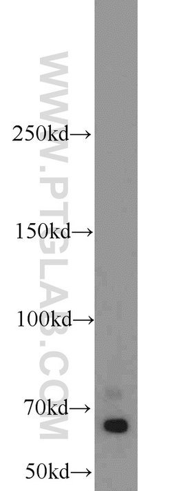 EGR2 Rabbit anti-Human, Mouse, Rat, Polyclonal, Proteintech 150 &mu;L;