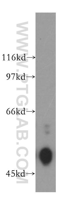 EGR2 Rabbit anti-Human, Mouse, Rat, Polyclonal, Proteintech 150 &mu;L;