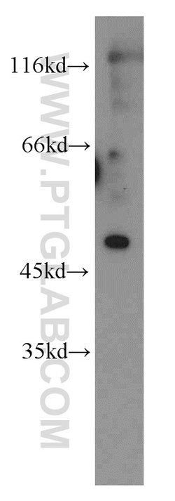 EGR2 Rabbit anti-Human, Mouse, Rat, Polyclonal, Proteintech 150 &mu;L;