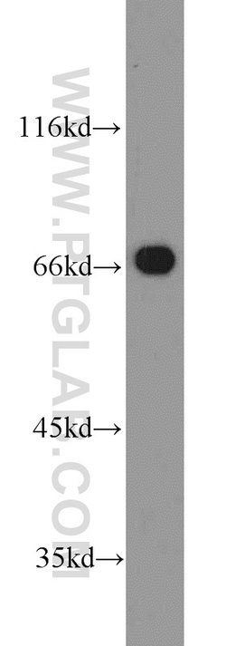 EGR2 Rabbit anti-Human, Mouse, Rat, Polyclonal, Proteintech 150 &mu;L;
