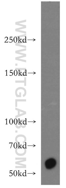 CDH23 Rabbit anti-Human, Mouse, Rat, Polyclonal, Proteintech 150 &mu;L;