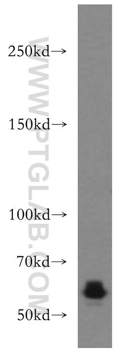 CDH23 Rabbit anti-Human, Mouse, Rat, Polyclonal, Proteintech 150 &mu;L;