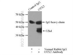 OTX2 Rabbit anti-Human, Mouse, Rat, Polyclonal, Proteintech 150 &mu;L;