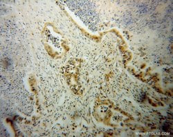 NGB Rabbit anti-Human, Mouse, Rat, Polyclonal, Proteintech:Antibodies:Primary
