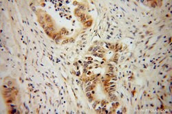 NGB Rabbit anti-Human, Mouse, Rat, Polyclonal, Proteintech:Antibodies:Primary