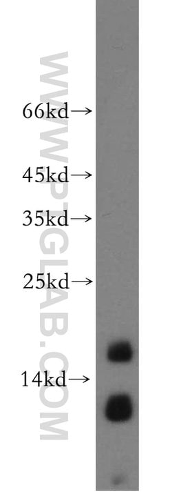 NGB Rabbit anti-Human, Mouse, Rat, Polyclonal, Proteintech:Antibodies:Primary