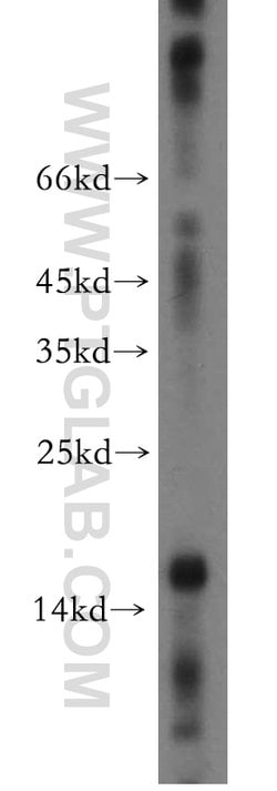 NGB Rabbit anti-Human, Mouse, Rat, Polyclonal, Proteintech:Antibodies:Primary
