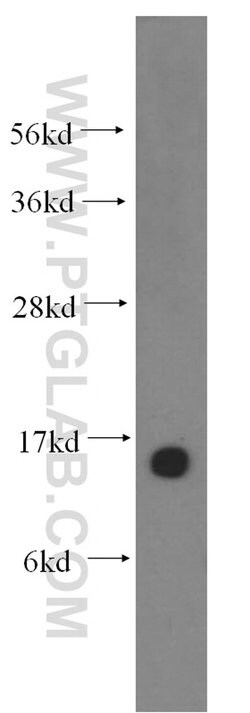 NGB Rabbit anti-Human, Mouse, Rat, Polyclonal, Proteintech:Antibodies:Primary