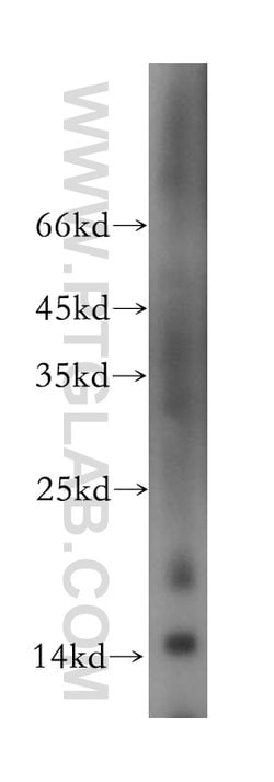 NGB Rabbit anti-Human, Mouse, Rat, Polyclonal, Proteintech:Antibodies:Primary
