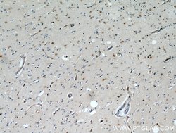 GPX7 Rabbit anti-Human, Polyclonal, Proteintech:Antibodies:Primary Antibodies