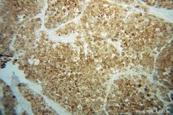 GPX7 Rabbit anti-Human, Polyclonal, Proteintech:Antibodies:Primary Antibodies