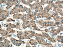 GPX7 Rabbit anti-Human, Polyclonal, Proteintech:Antibodies:Primary Antibodies
